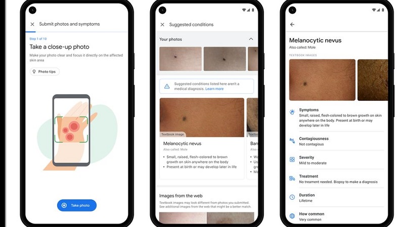 Google AI tool can help patients identify skin conditions | Loop Nauru